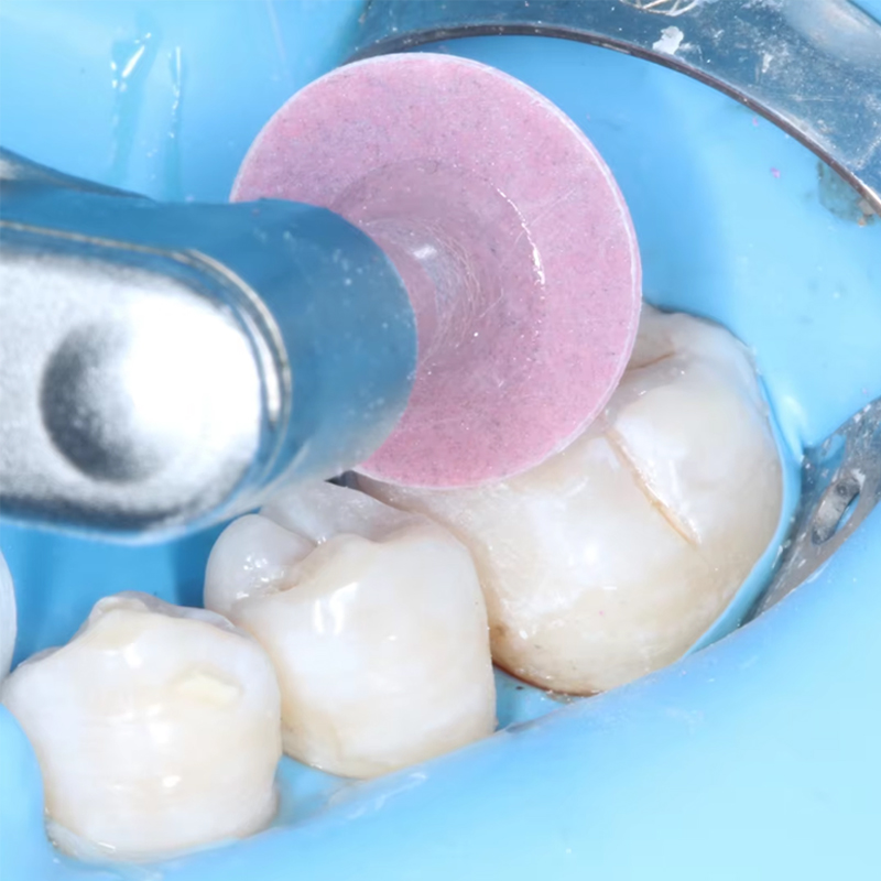 40 Pezzi Dischi Lucidanti Dent - Teeth Whitening Express recensione e prezzo