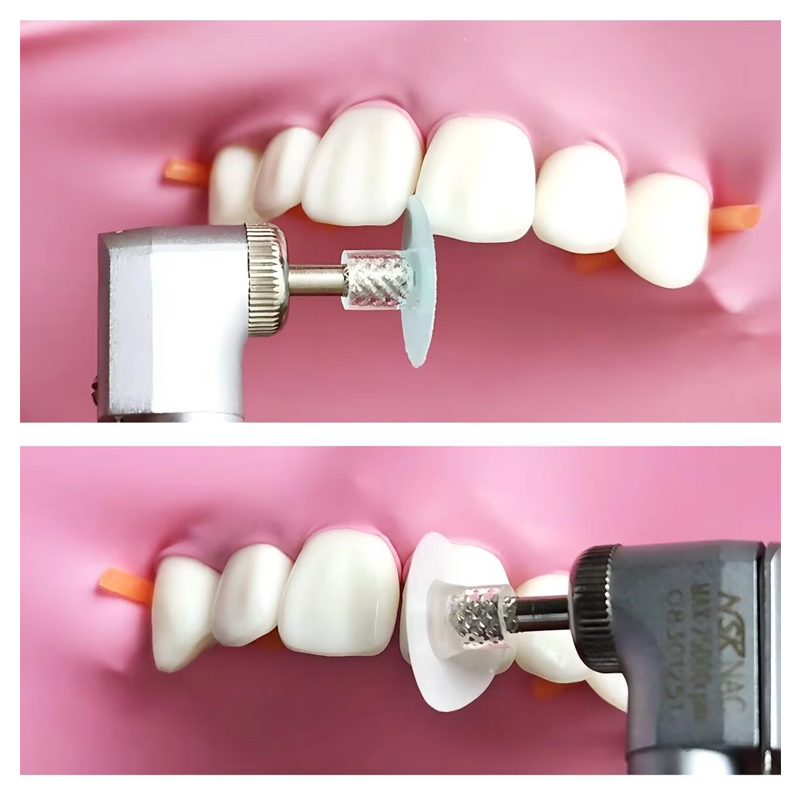 40 Pezzi Dischi Lucidanti Dent - Teeth Whitening Express recensione e prezzo