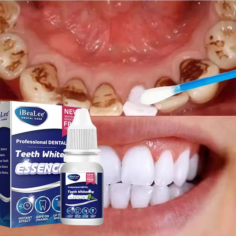 Essenza sbiancante per denti,  - Teeth Whitening Serum recensione e prezzo