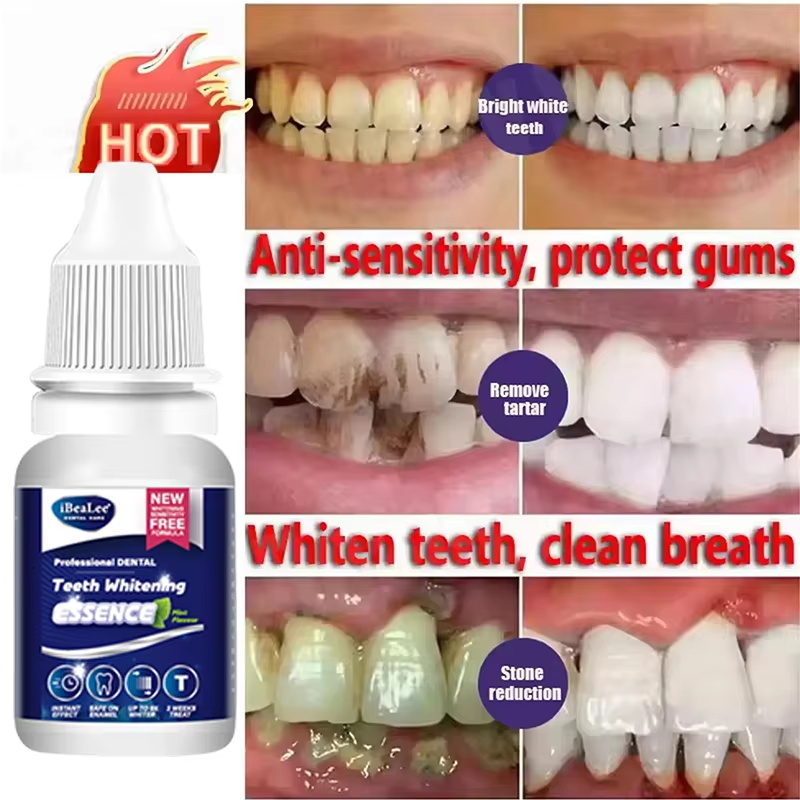 Essenza sbiancante per denti,  - Teeth Whitening Serum recensione e prezzo