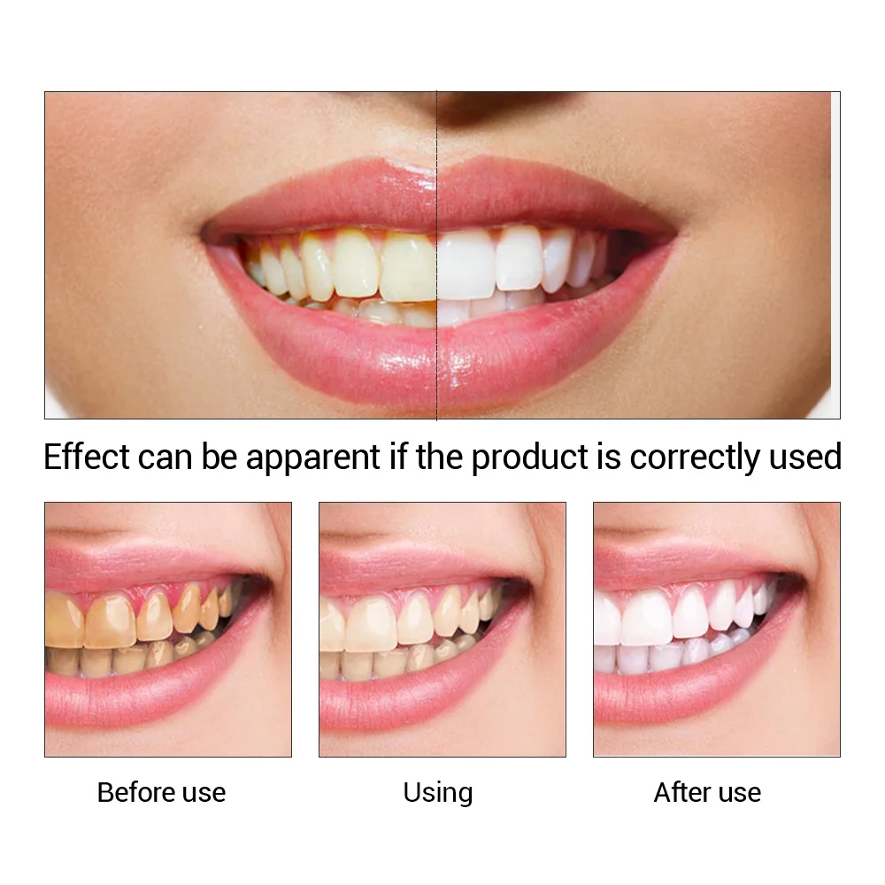 FTEENPLY Sbiancamento Dei Dent - Teeth Whitening Serum recensione e prezzo
