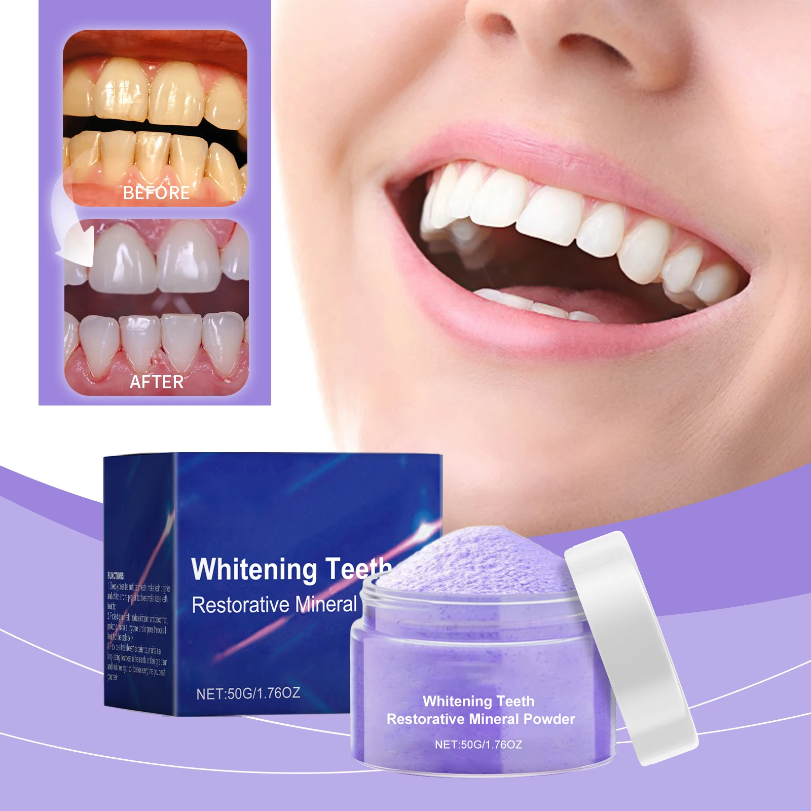Kit Sbiancante Denti di Nuova  - Teeth Whitening Serum recensione e prezzo