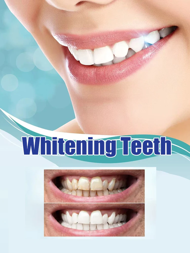 Kit Sbiancante Denti di Nuova  - Teeth Whitening Serum recensione e prezzo