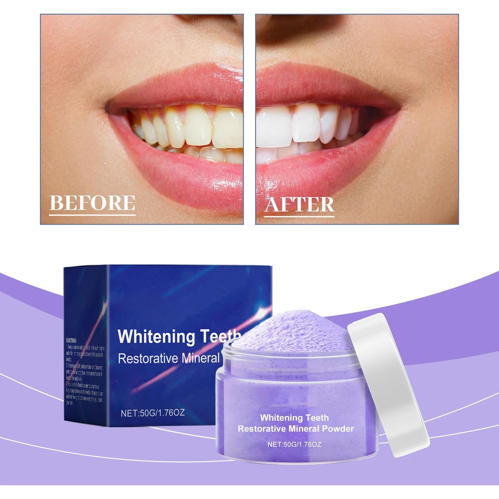 Kit Sbiancante Denti di Nuova  - Teeth Whitening Serum recensione e prezzo