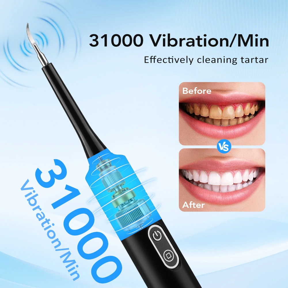 Scalatore Dentale Elettrico a  - Teeth Whitening Express recensione e prezzo